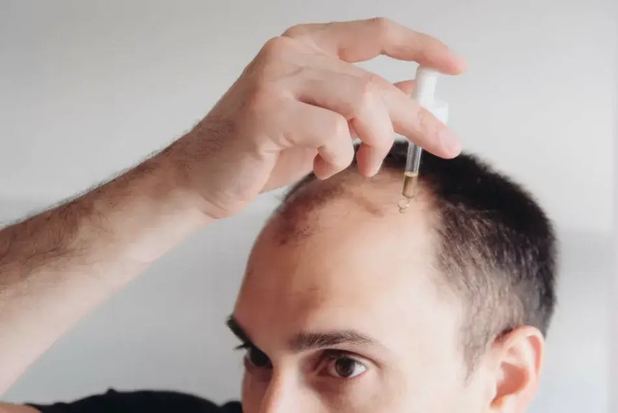 How a Hair Specialist Doctor Diagnoses Hidden Hair Issues