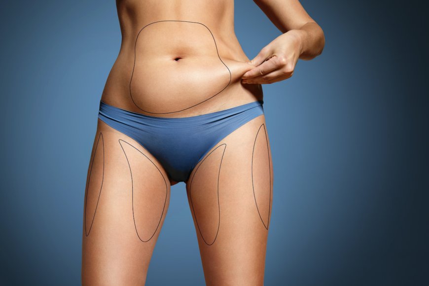 Liposuction Exercise: Which One Delivers Faster Body Results?