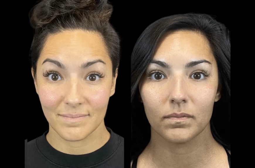 Exploring Anti-Aging Innovations at the Best Aesthetic Clinic in Dubai