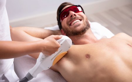 Full Body Laser Hair Removal: Does It Work for Men Too?