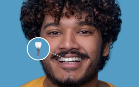 Are Dental Implants Right for You? North York’s Guide to a Confident Smile