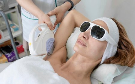 Can Laser Hair Removal Trigger Acne or Breakouts?