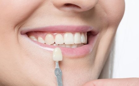 Can Dental Veneers Help with Uneven Tooth Lengths?