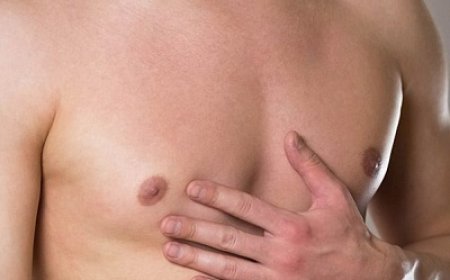 How Much Does Gynecomastia Surgery Cost? A Complete Guide