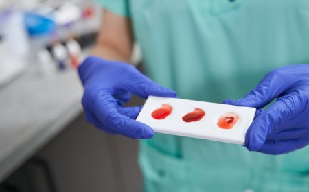 Blood Test at Home: What to Expect Before, During, and After