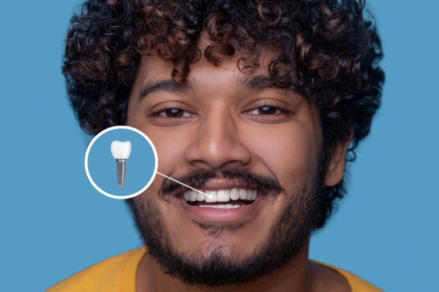 Are Dental Implants Right for You? North York’s Guide to a Confident Smile