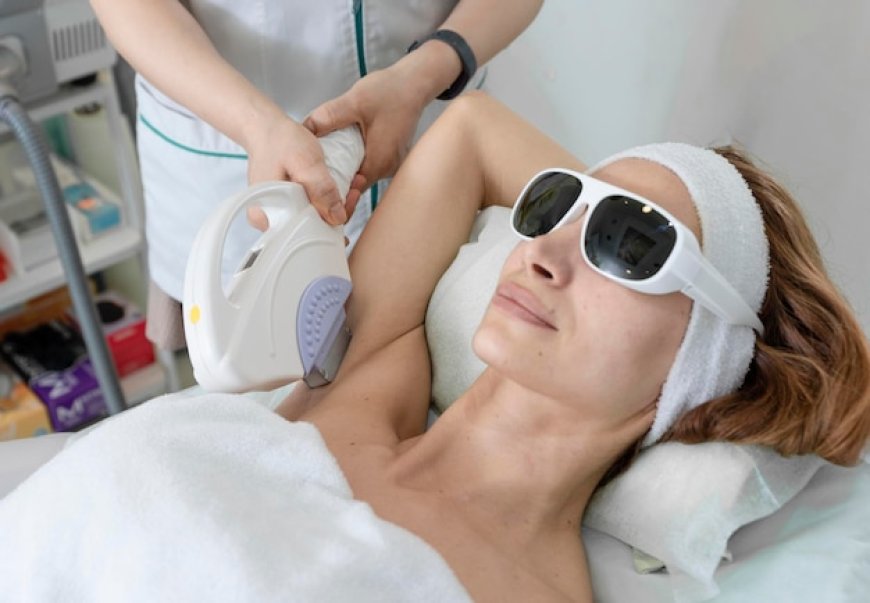 Can Laser Hair Removal Trigger Acne or Breakouts?