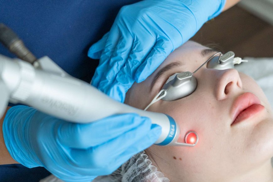 Say Goodbye to Freckles With Pico Laser Treatment