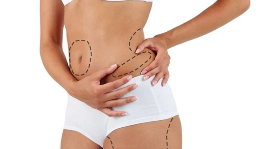 Is a Tummy Tuck in Dubai Right for You? Factors to Consider Before Surgery