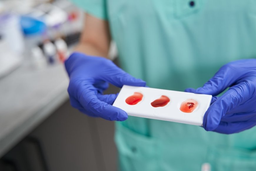 Blood Test at Home: What to Expect Before, During, and After